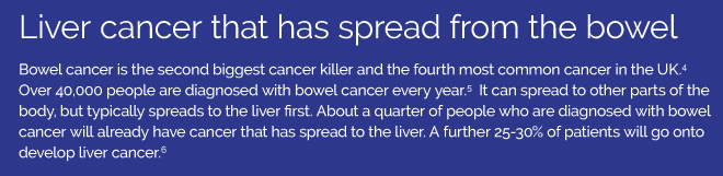 Liver cancer that has spread from the bowel  Bowel cancer is the second biggest cancer killer and the fourth most common cancer in the UK.4 Over 40,000 people are diagnosed with bowel cancer every year.5  It can spread to other parts of the body, but typically spreads to the liver first. About a quarter of people who are diagnosed with bowel cancer will already have cancer that has spread to the liver. A further 25-30% of patients will go onto develop liver cancer.6