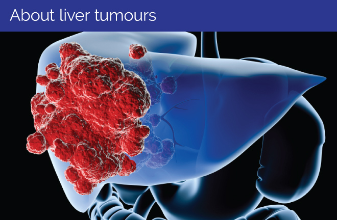 About liver tumours